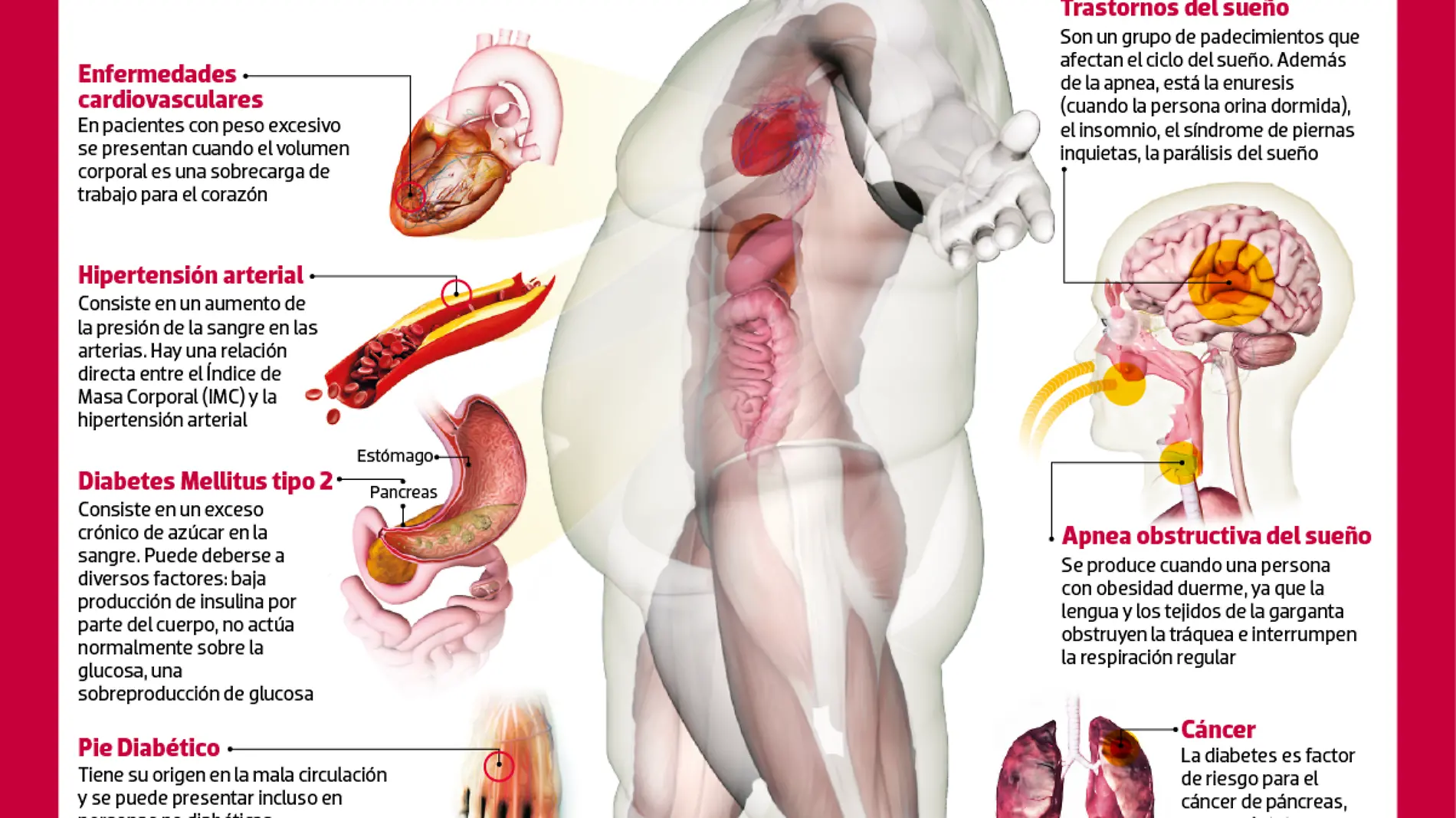 Enfermedades Obesidad-01